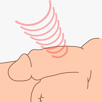 체외충격파 시술과정02