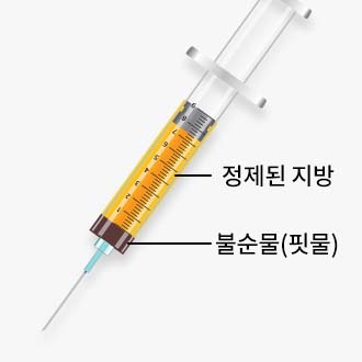 체외충격파 시술과정02