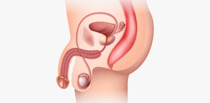 체외충격파 시술과정01