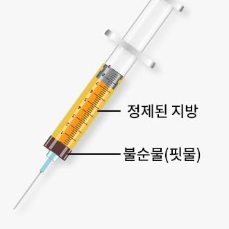 체외충격파 시술과정02